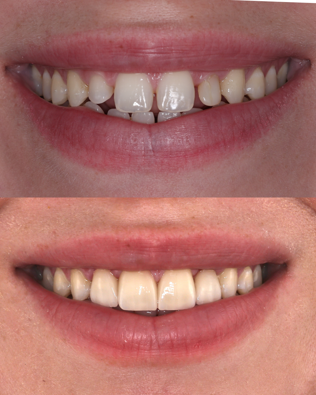 Untitled design (2).png