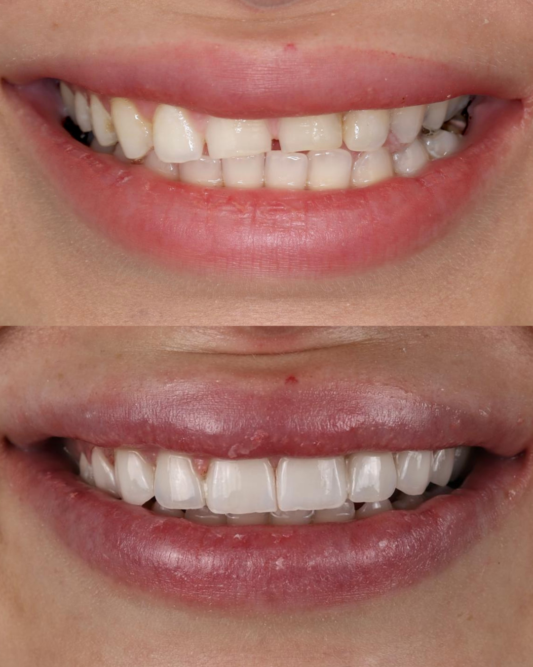 Untitled design (3).png