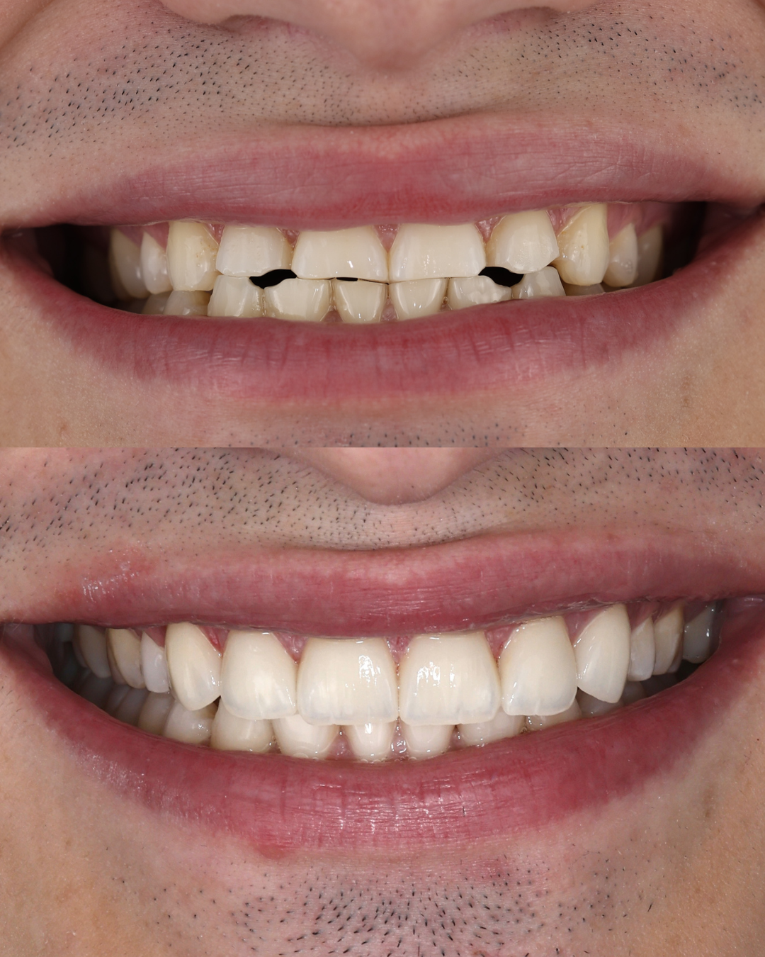 Untitled design (4).png