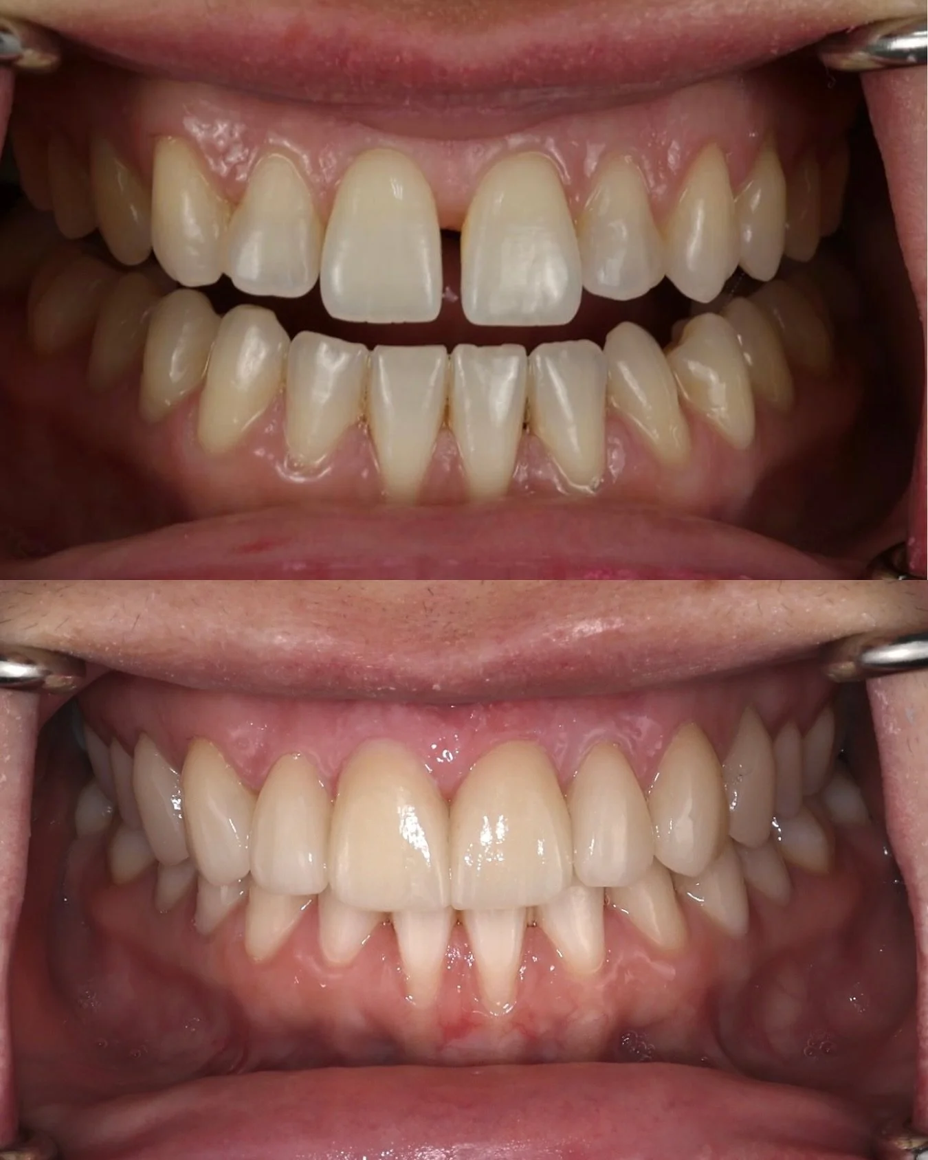 laminados resina.jpg