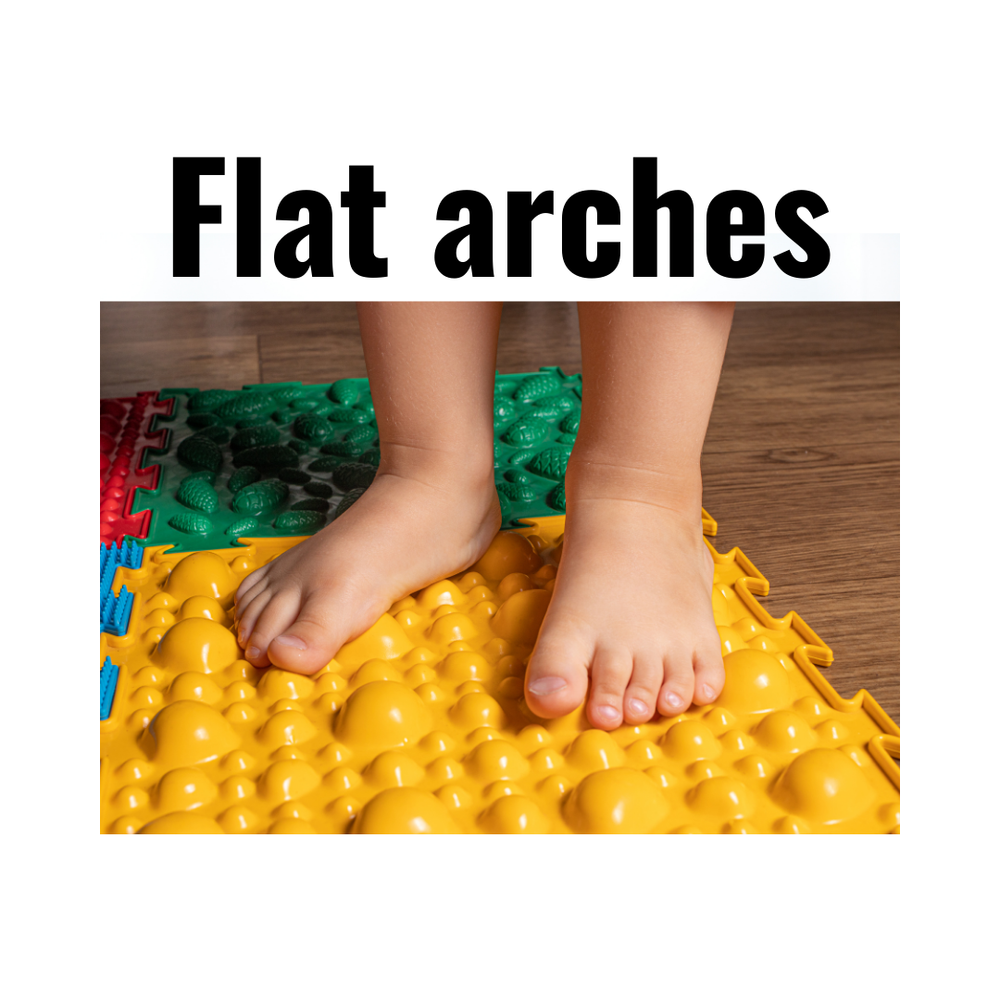 flat arches.png