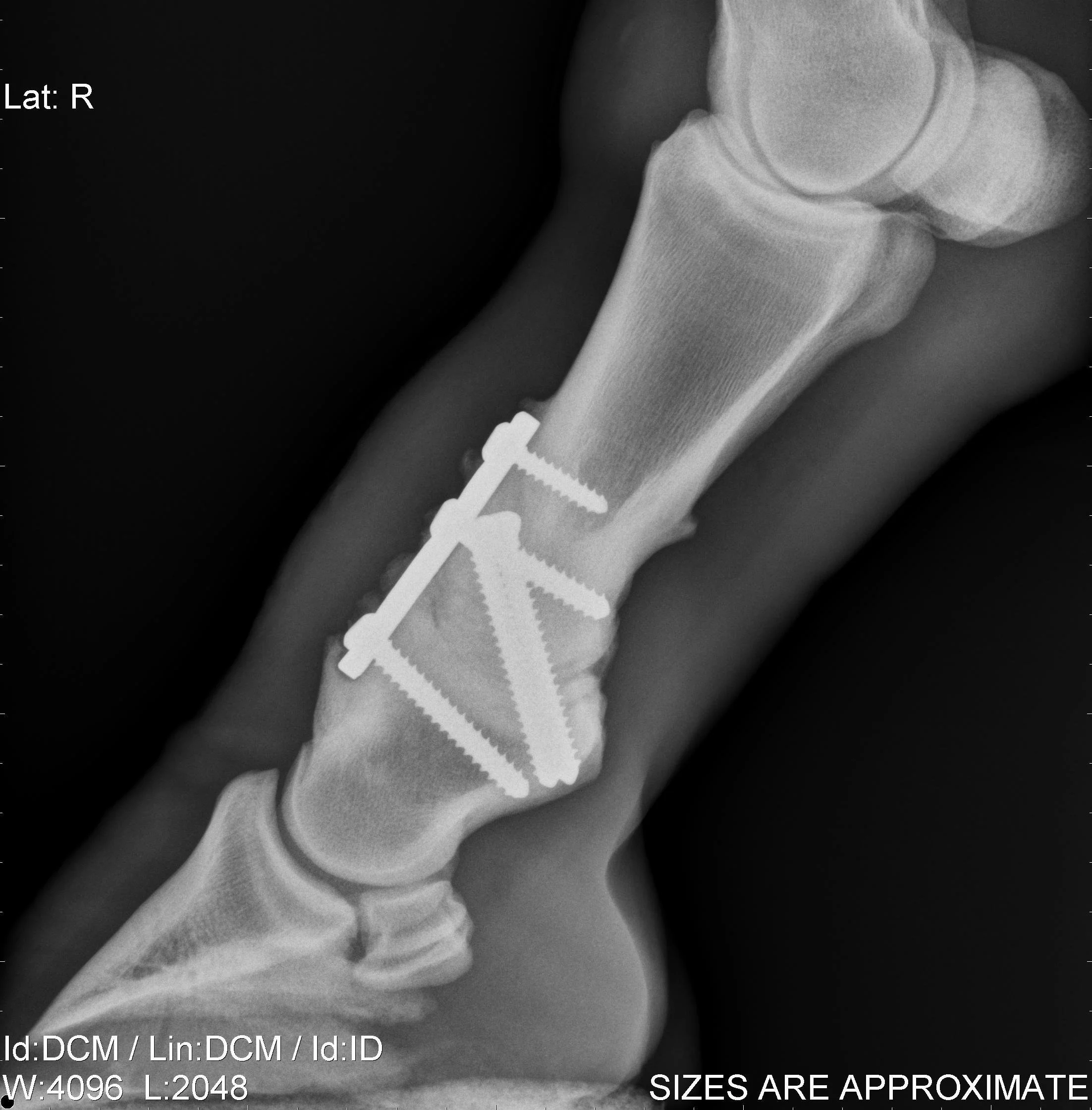 ARTHRODESIS PASTERN.jpg