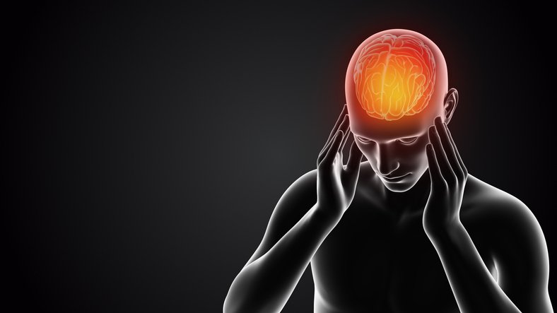 Migraine in Primary Care