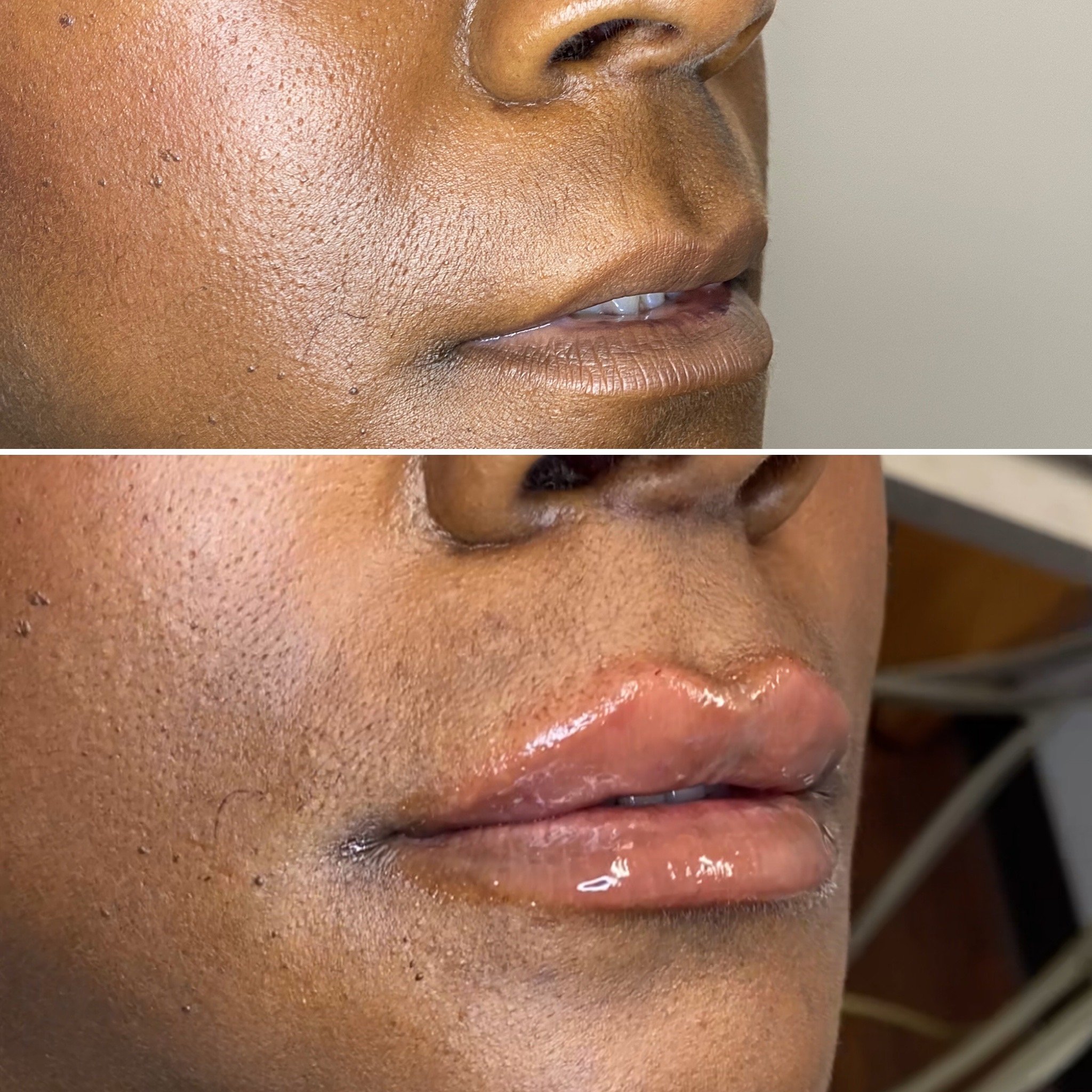 Lips