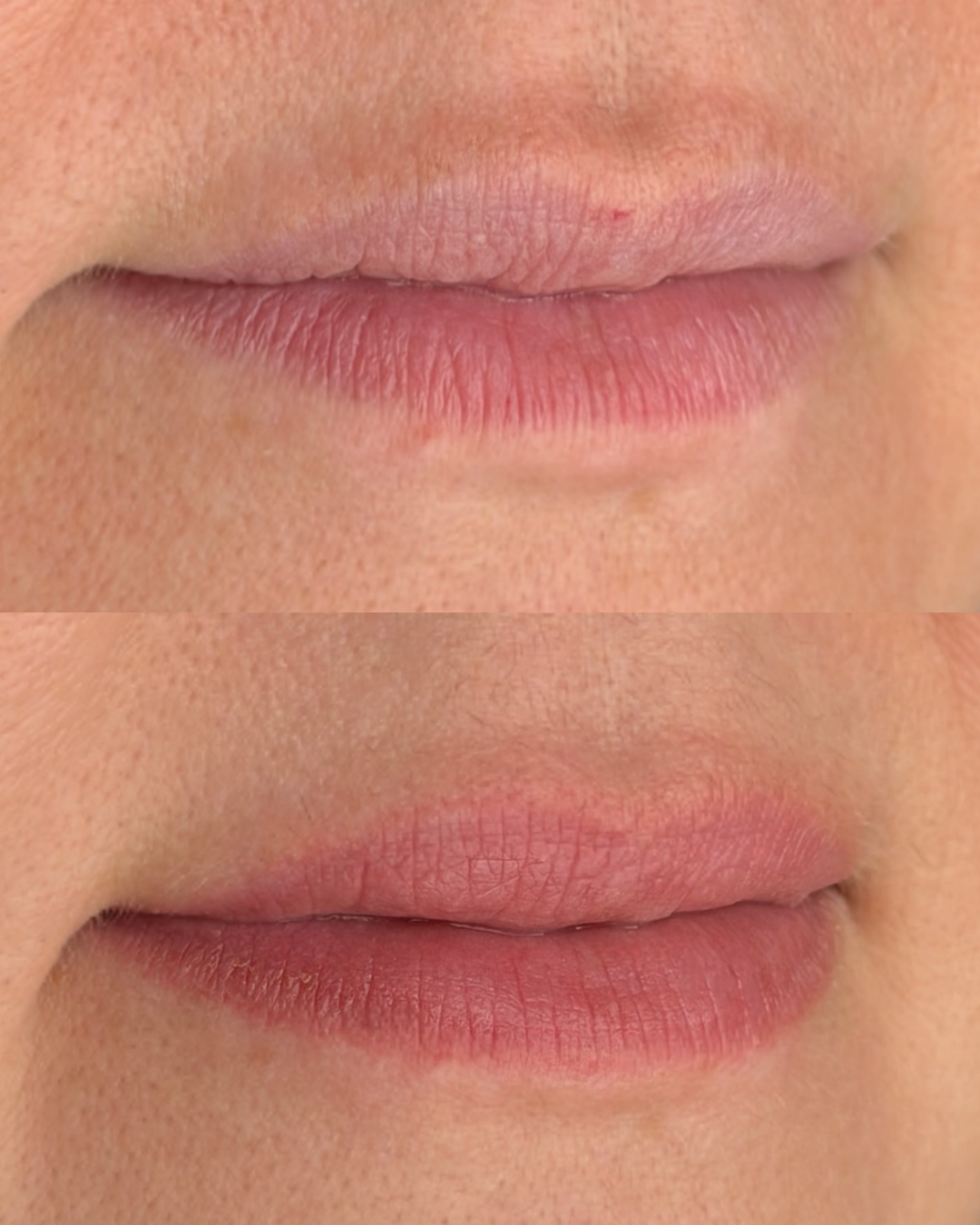 Lip blush before and healed after 6 weeks 