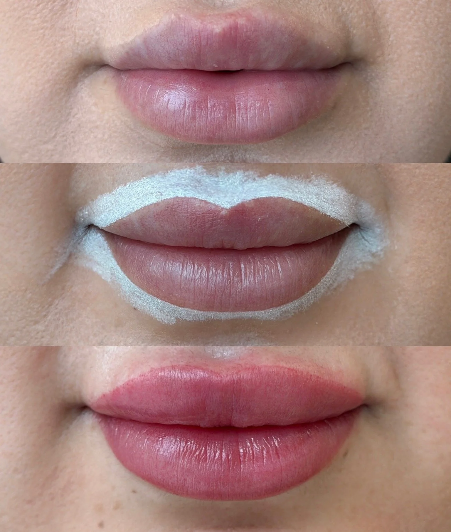 Before/ Mapped/ Immediately After Procedure