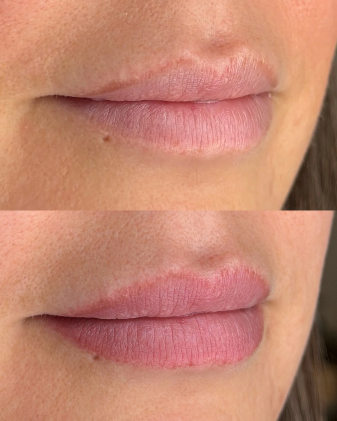 Lip Blush before and healed 