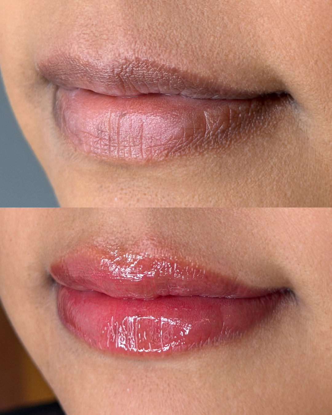 Before/ Immediately After Procedure