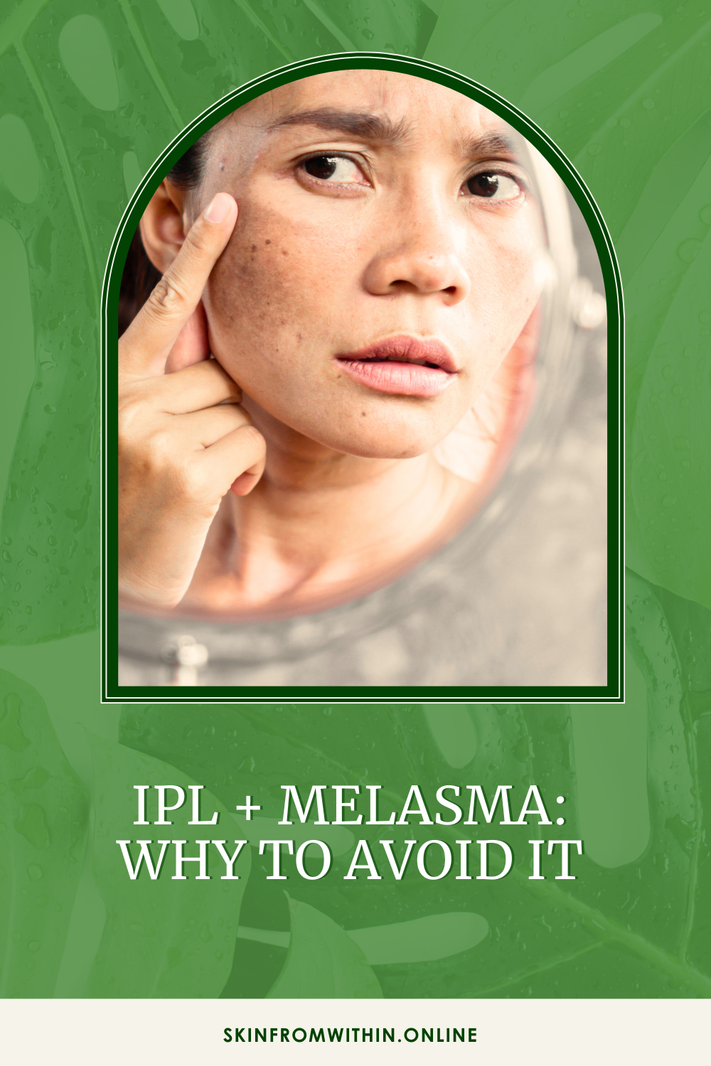 IPL + Melasma Why to avoid it — Skin From Within Beauty Skin and