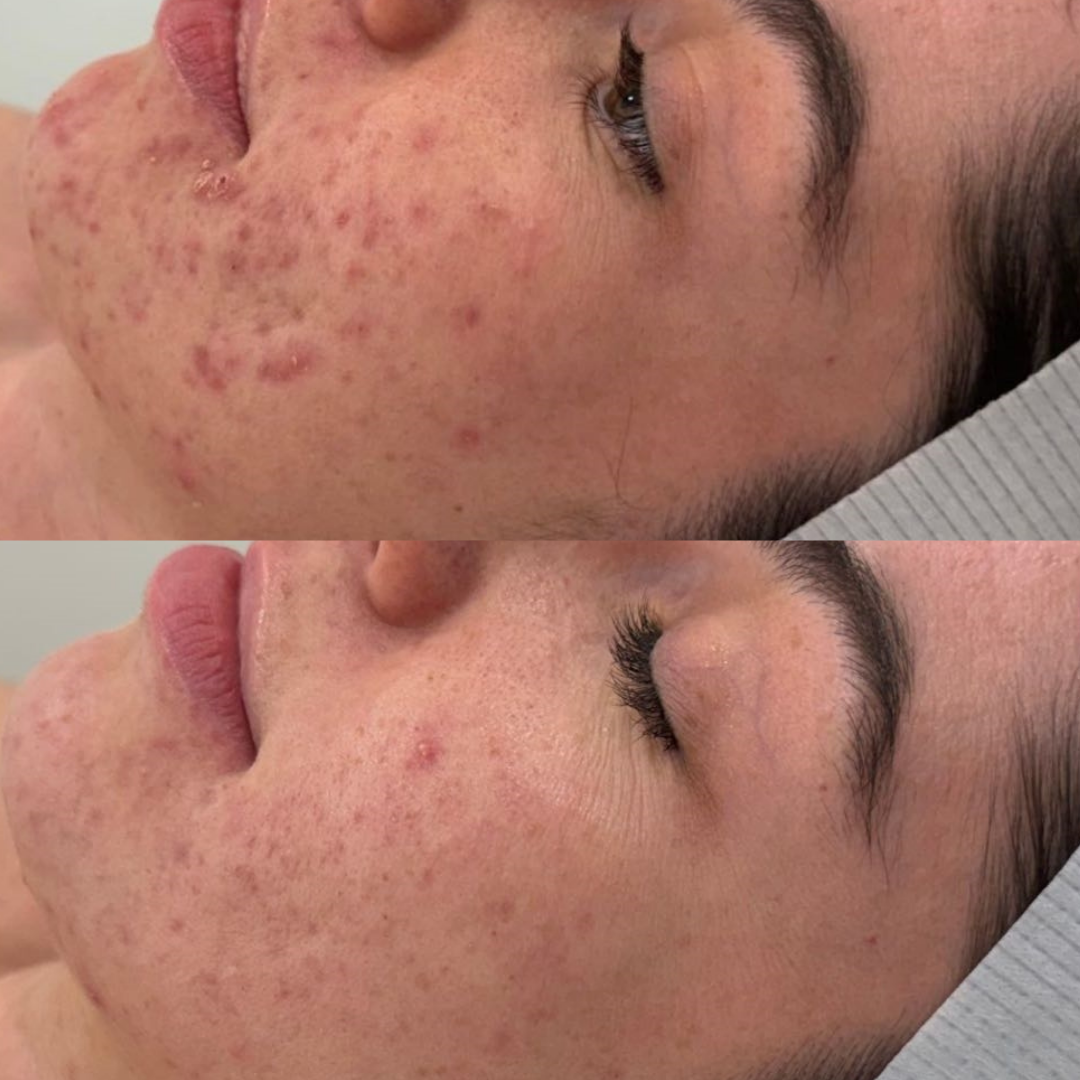 Before and Afters for web (3).png