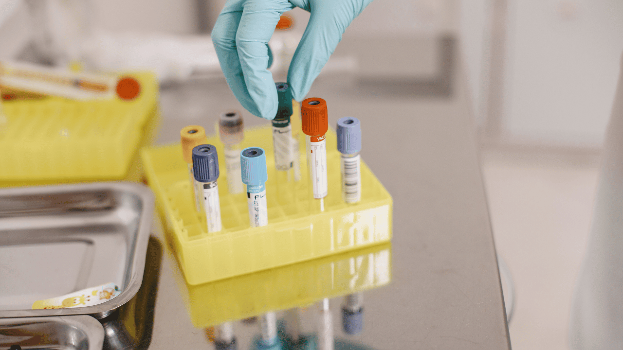 Does Ketamine Show Up on a 12 Panel Drug Test?