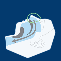 Rednet Cpap SleepNet