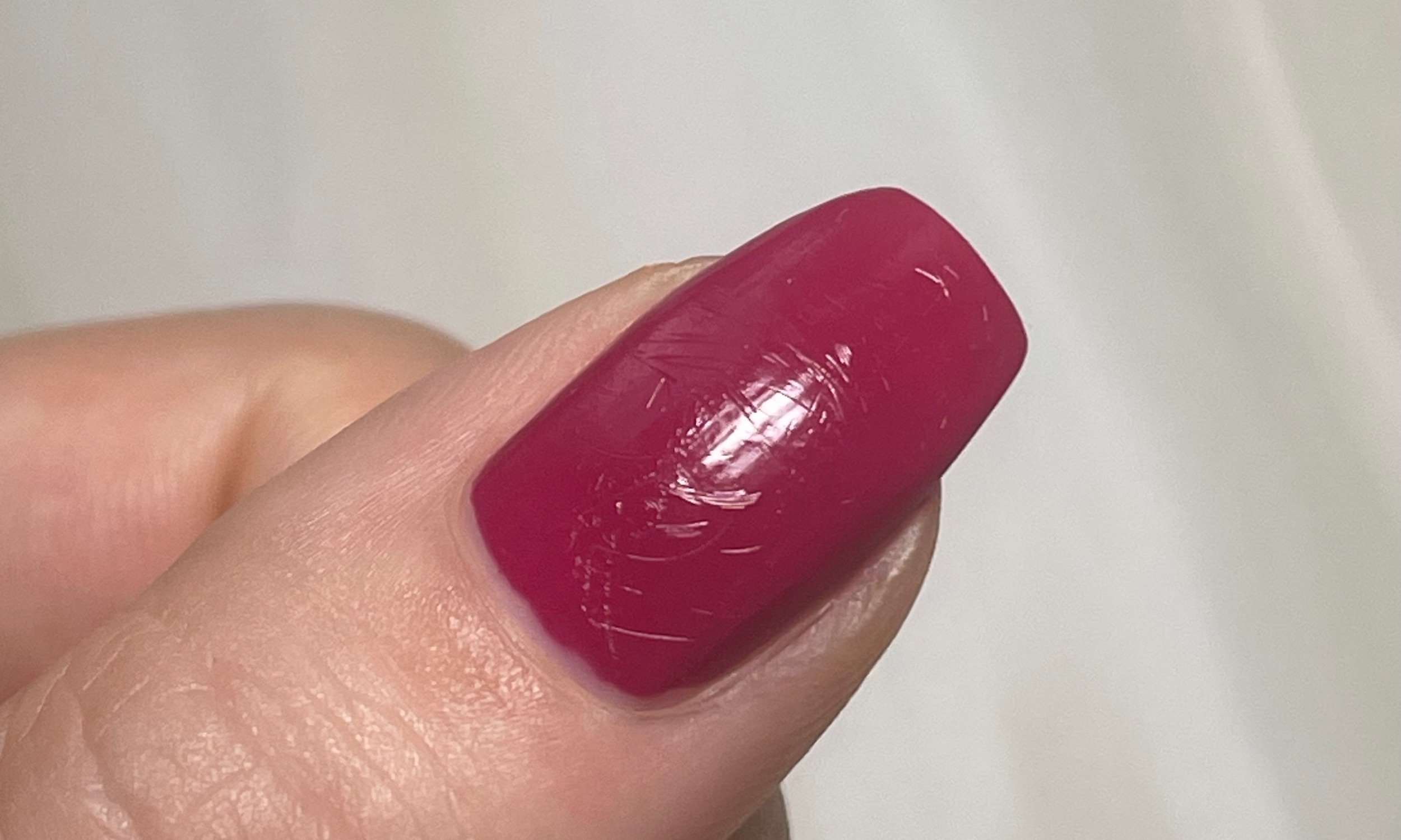 Vertical lines on the nails (3)#verticalline #nails #fingers #tiktok #... |  melanoma nail | TikTok