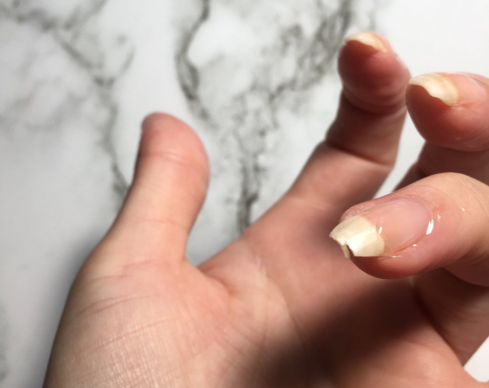 3 Ways To Repair A Broken Natural Nail At Home — Lots of Lacquer