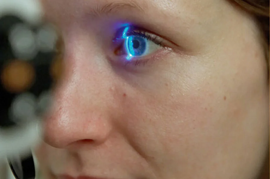 Do You Have the Symptoms of Glaucoma?