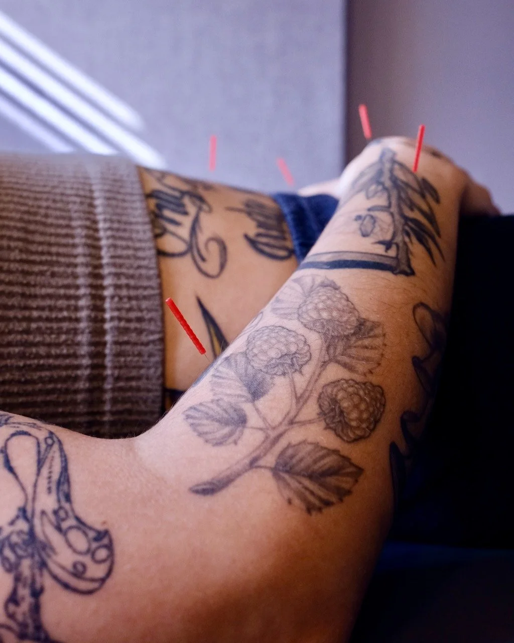 Treatments Acupuncture, Cupping & More — Acuworx — Acuworx