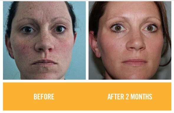 reverse brightening.jpg