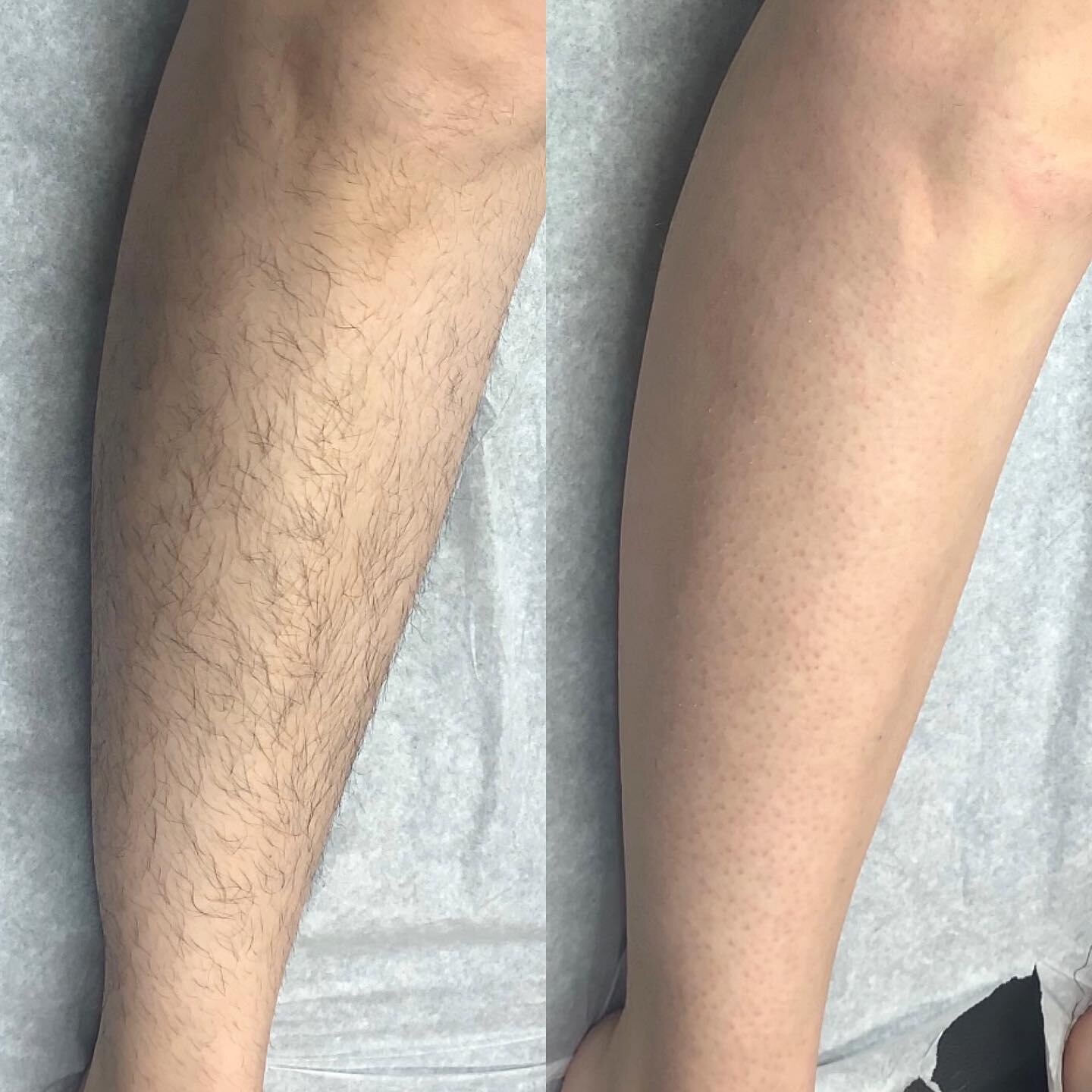 S A T I S F Y I N G
.
Let&rsquo;s grow some leg hair out so we can wax those puppies in time for summer!
.
Remember, when waxing your legs moisturizing is just as important as exfoliating! Dry legs mean dry hair that is prone to breaking which can me