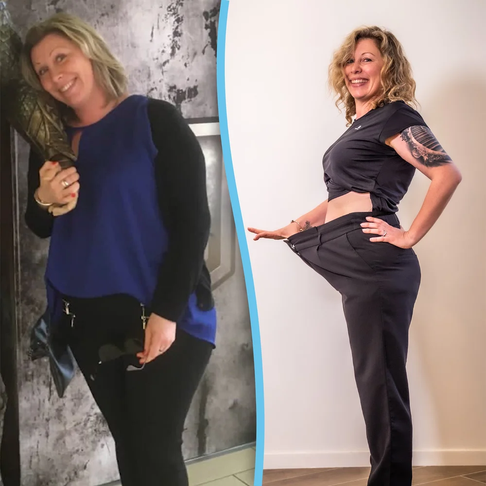 Allurion Balloon Procedure for Weight Loss | Vital Bariatrics