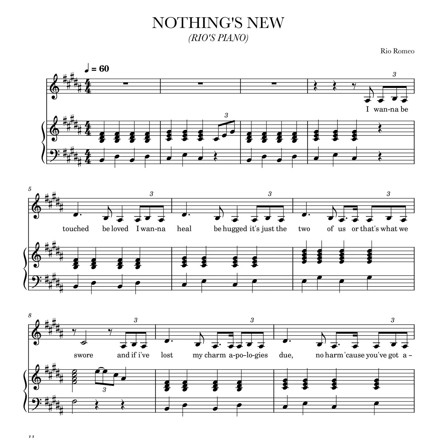 NOTHING_S_NEW-S-1.png.webp