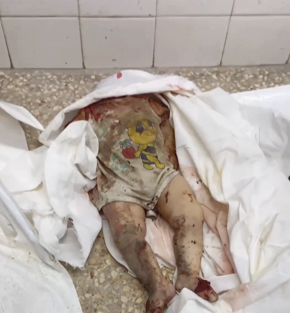   The body of a Palestinian child, beheaded in an Israeli airstrike on Gaza, lies in a hospital morgue—one of countless young victims of the bombardment.  