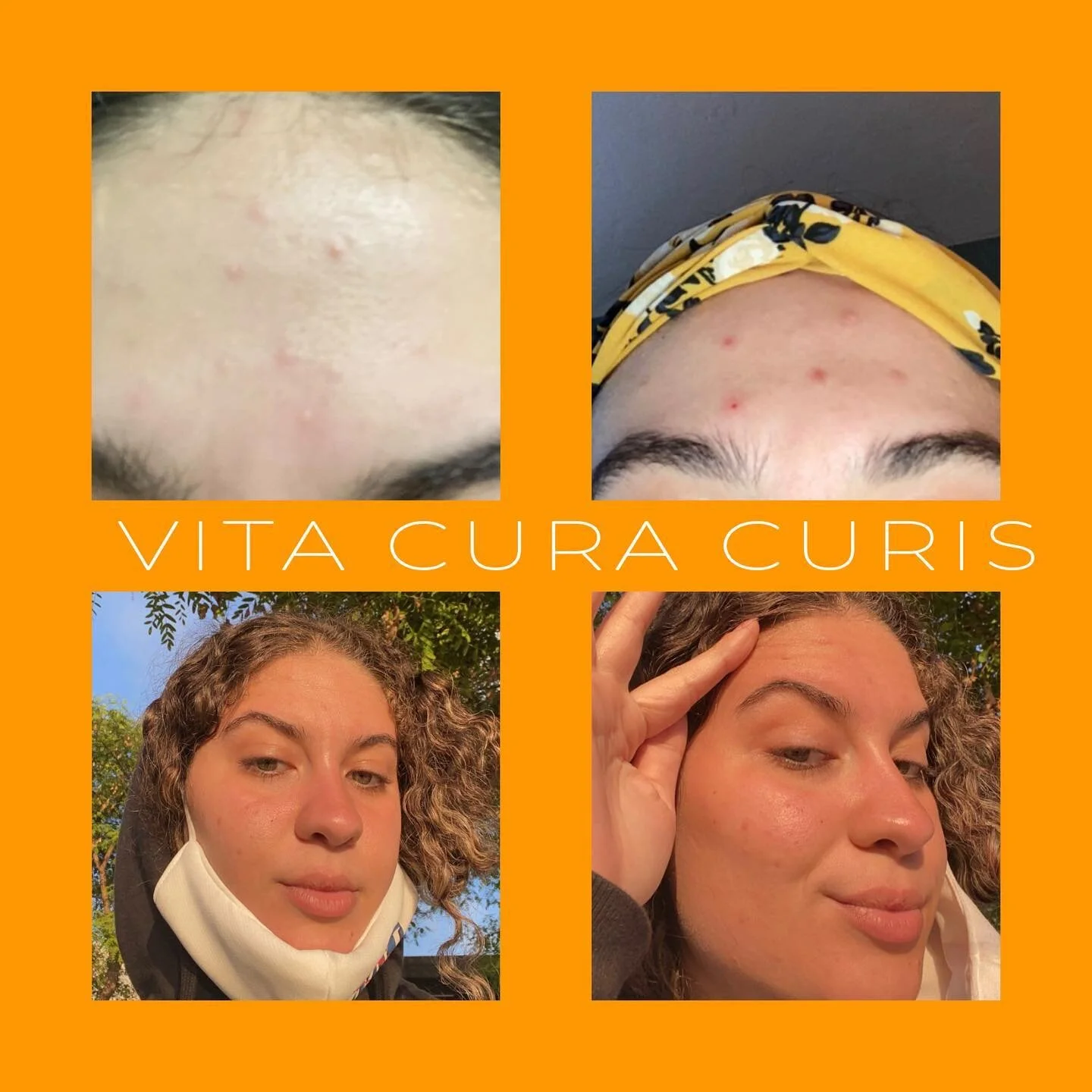 this beautiful gal has been using [the cleanser + mango butter + eye serum] twice a day for a week and look at the results😍 she is glowing baby 🌟
&bull;&bull;
take advantage of our memorial day weekend sale with code MEMV30 to enjoy 30% off your en