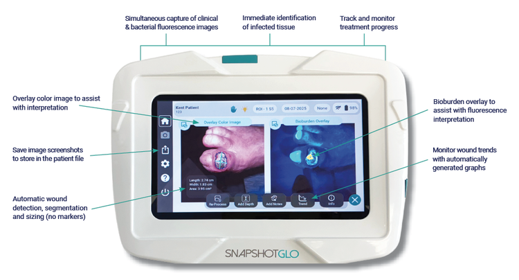 SnapshotGLO, a bacterial autofluorescence medical imaging device — Kent ...