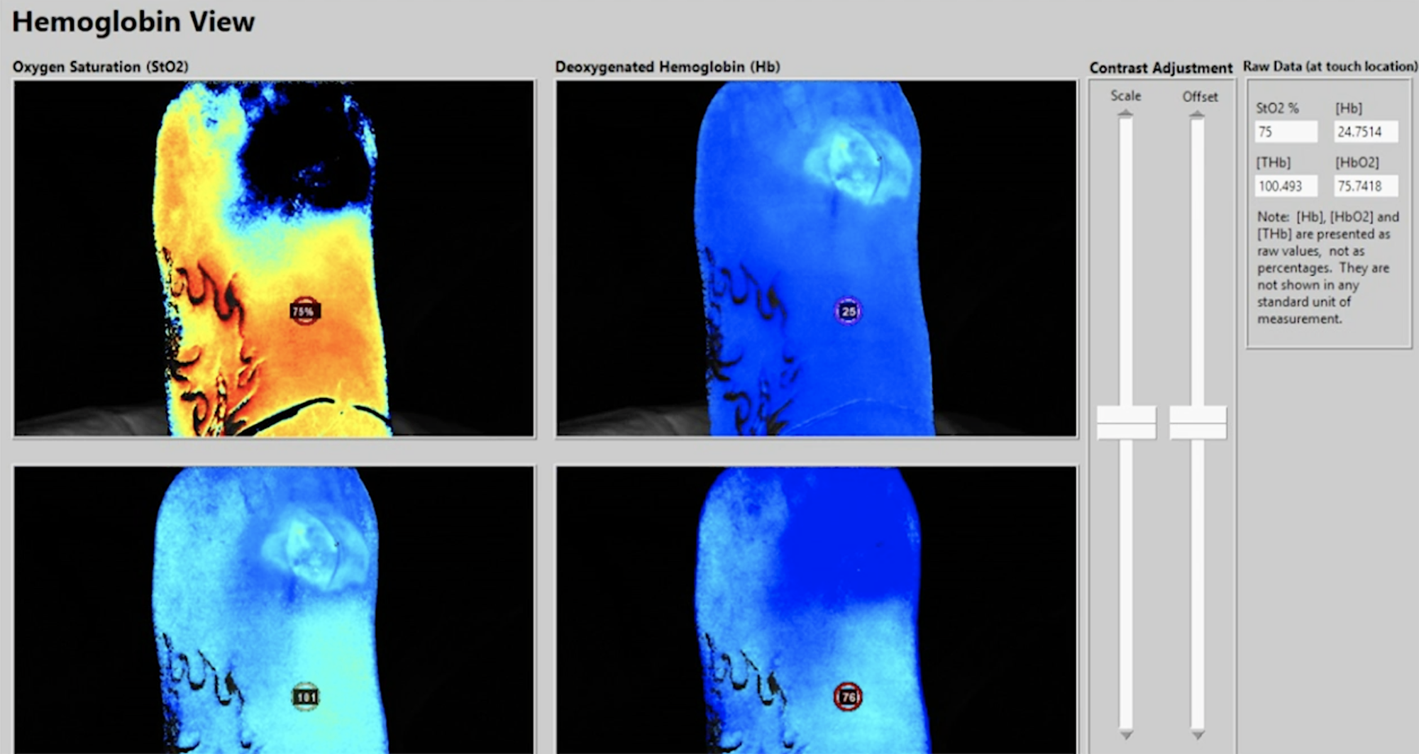 WEBINAR: Continuing to Improve Outcomes for Patients