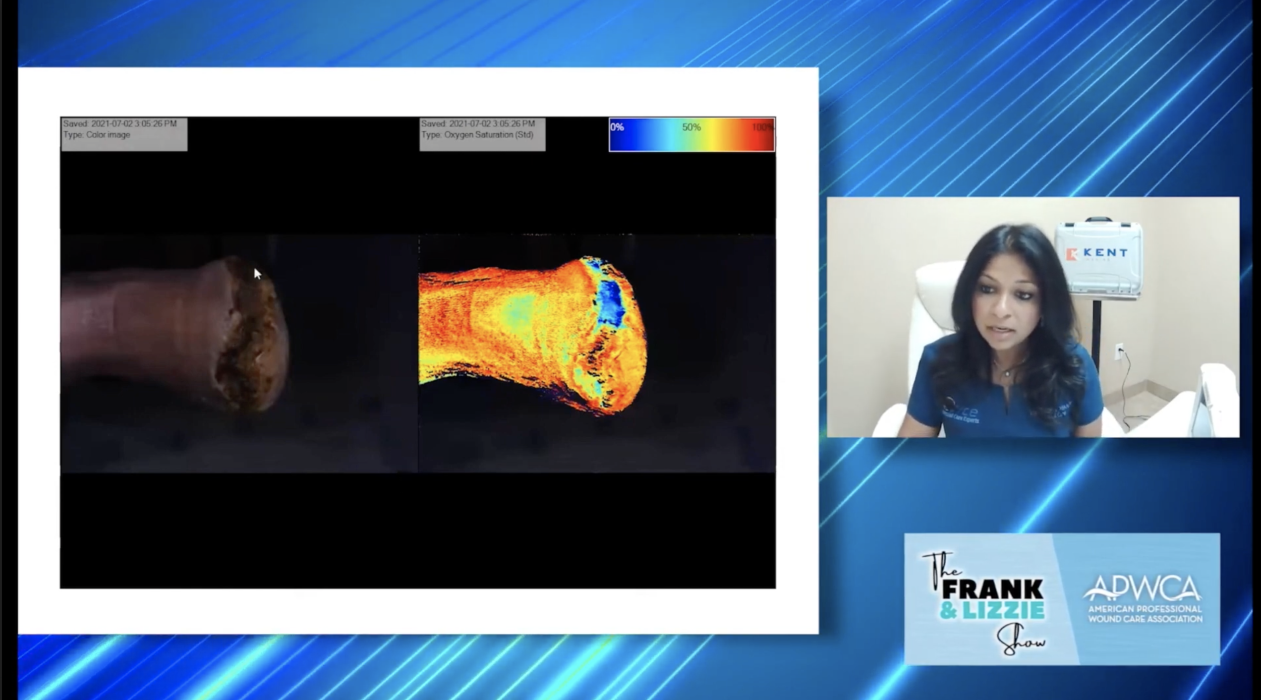 Clinical Education: Dr. Naz Wahab on the Frank &amp; Lizzie Show Featuring SnapshotNIR