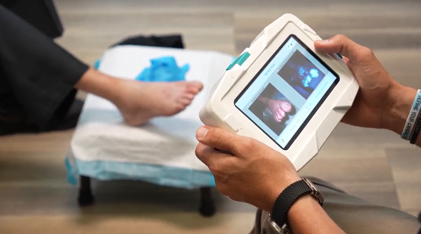 Kent Imaging Responds to a Complaint Filed with the ITC Concerning SnapshotGLO® and Reaffirms Commitment to Clinical Innovation