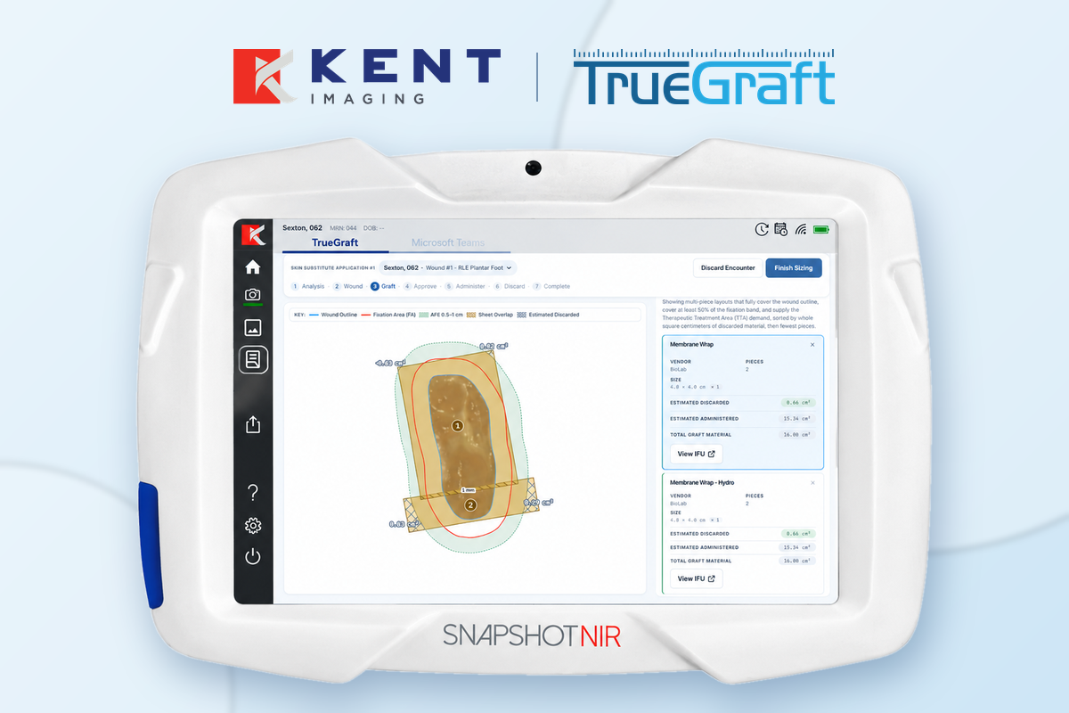 Kent Imaging Partners with TrueGraft to Integrate Precision Wound Sizing into the Snapshot Imaging Platform