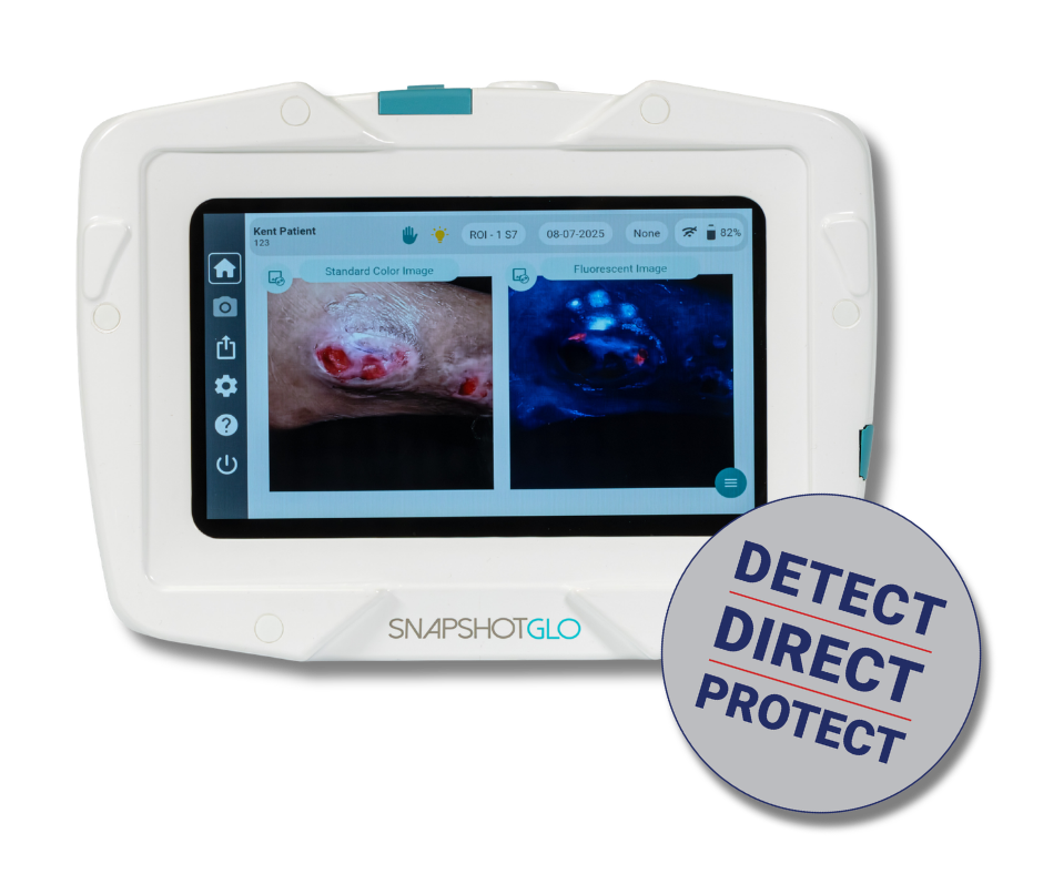SnapshotGLO and image with detect direct protect sticker