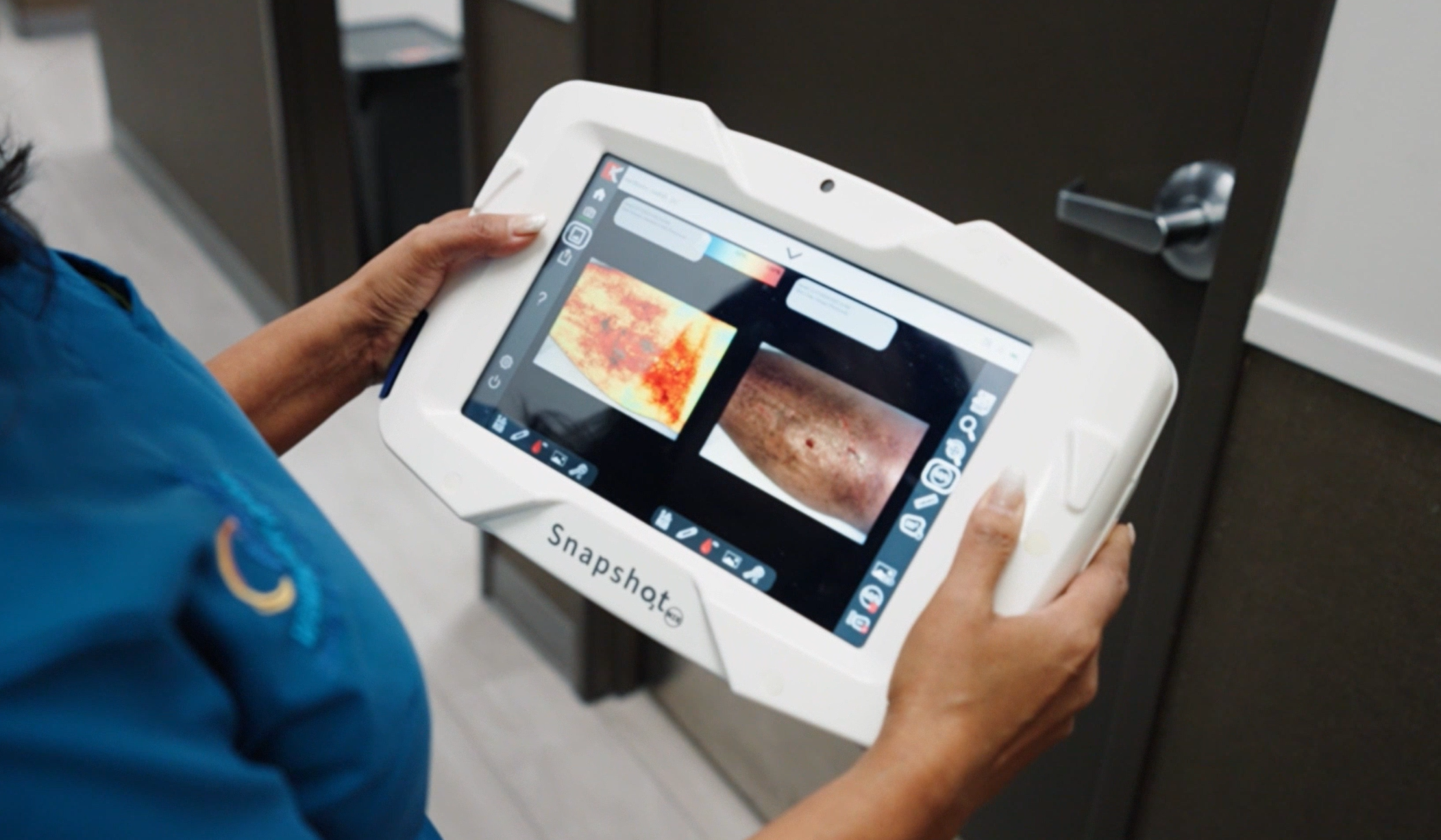 doctor holding snapshotNIR in her hands with leg on the screen