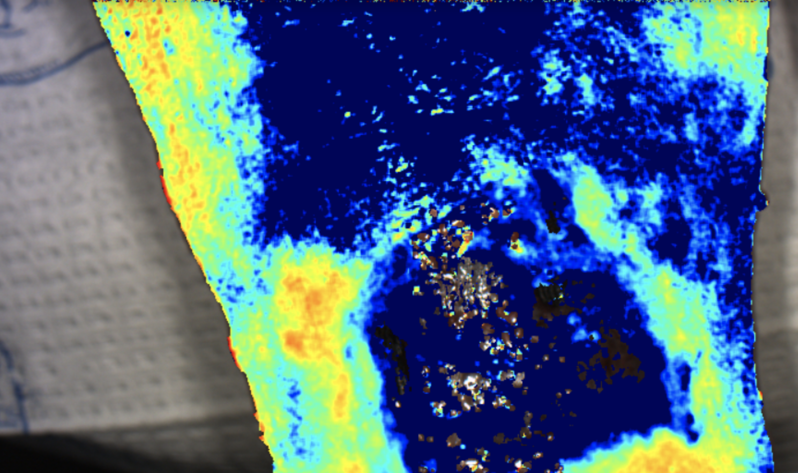 ENHANCING ENGAGEMENT WITH SERIAL IMAGING IN A PATIENT WITH SKIN FLAP REPLACEMENT