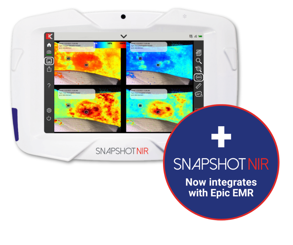SnapshotNIR device and blue sticker with white text stating SnapshotNIR integrates with Epic EMR