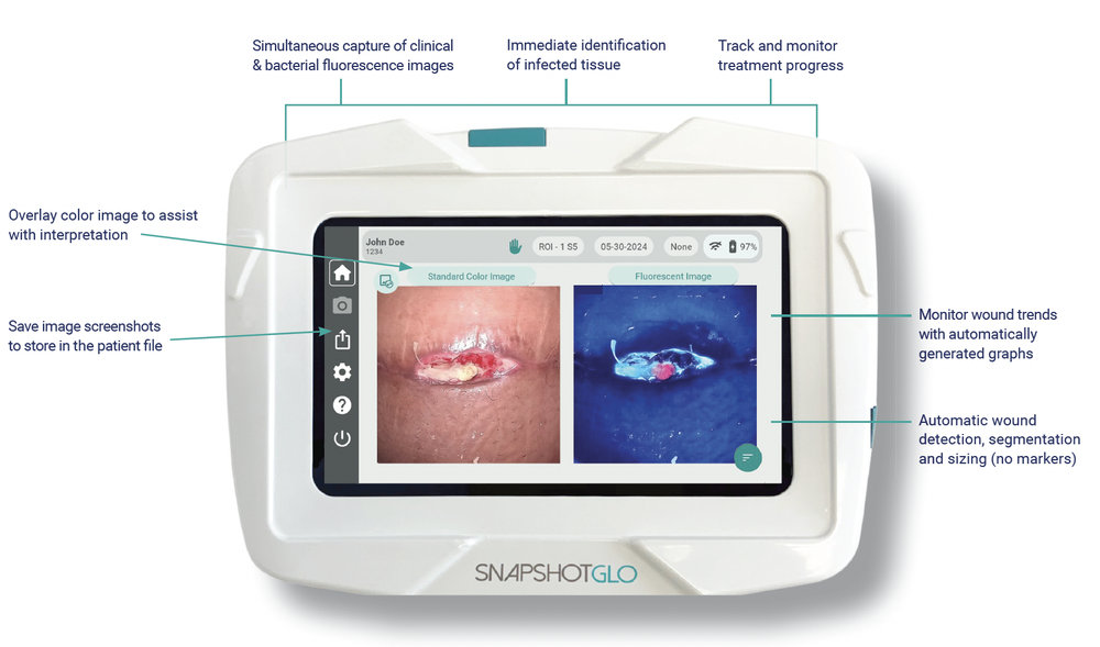 SnapshotGLO, a bacterial autofluorescence medical imaging device — Kent ...