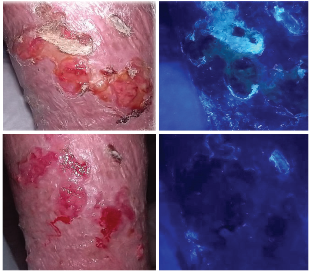 VLU sexton glo case 1 example pre nad post.png