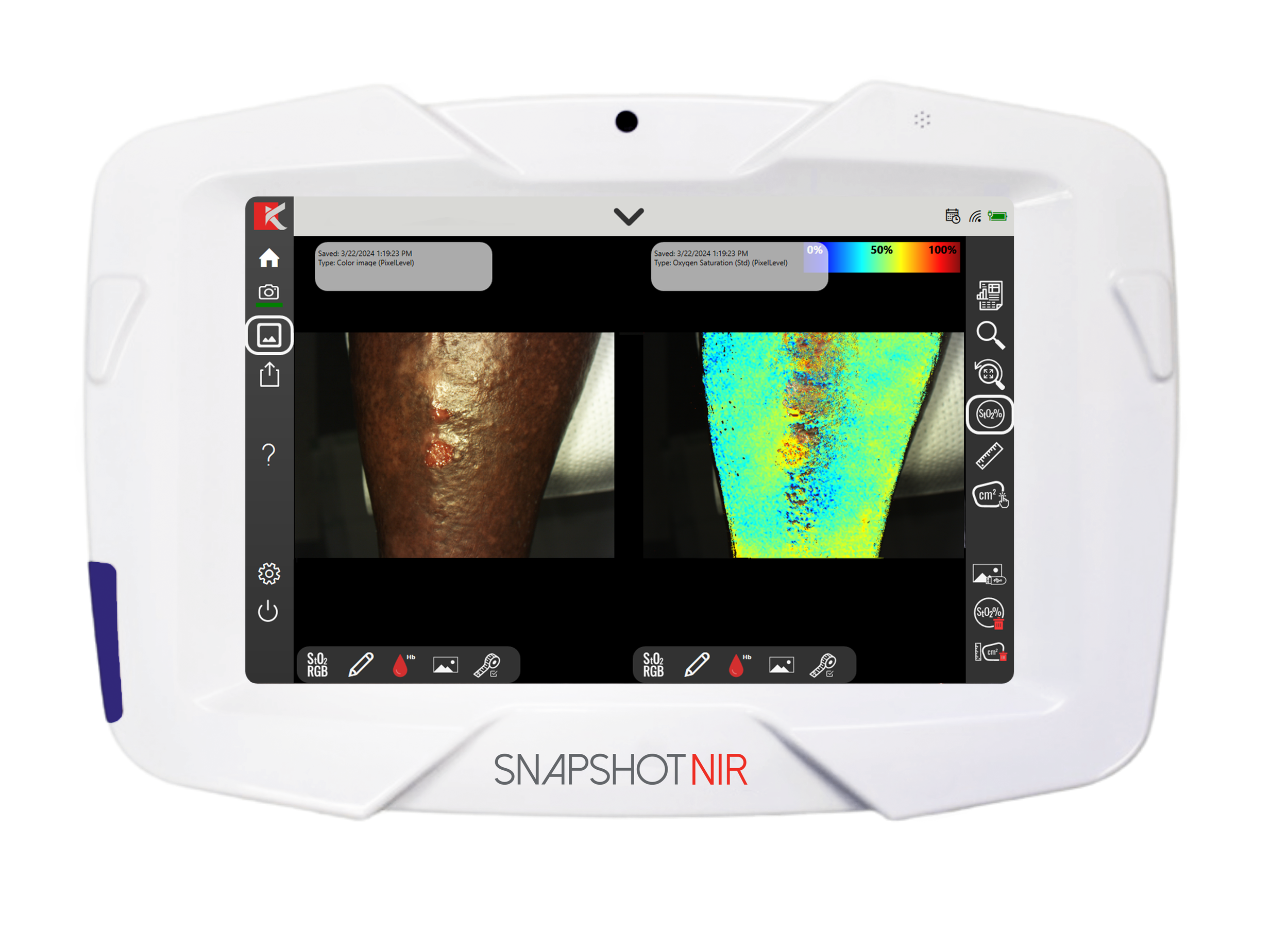 Kent Imaging Announces FDA Clearance of SnapshotNIR KD205 — Kent Imaging