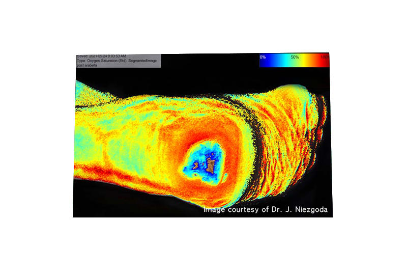 shadow debridement-002