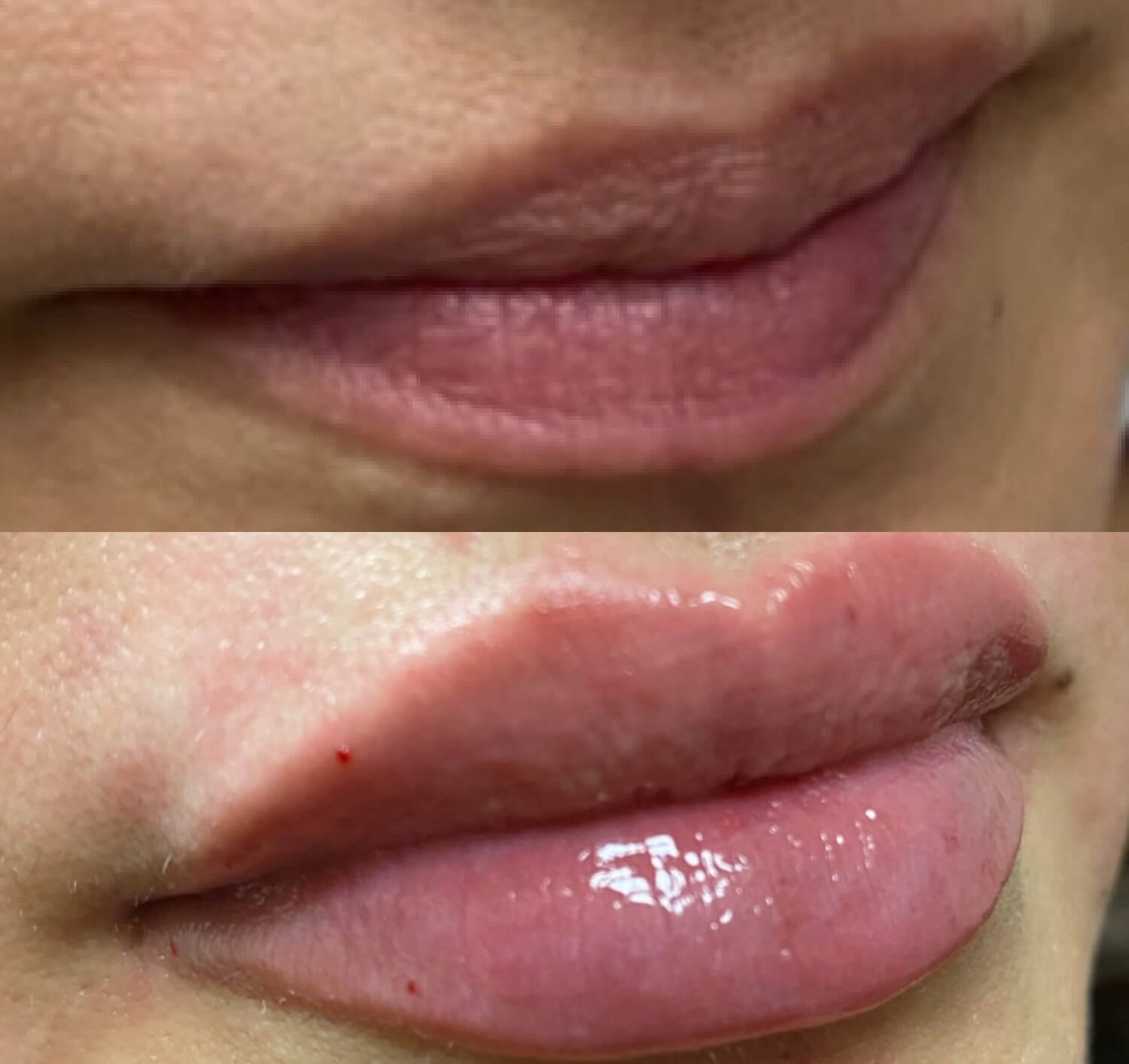 Ashley Farnham natural looking lip enhancement before and after.jpg