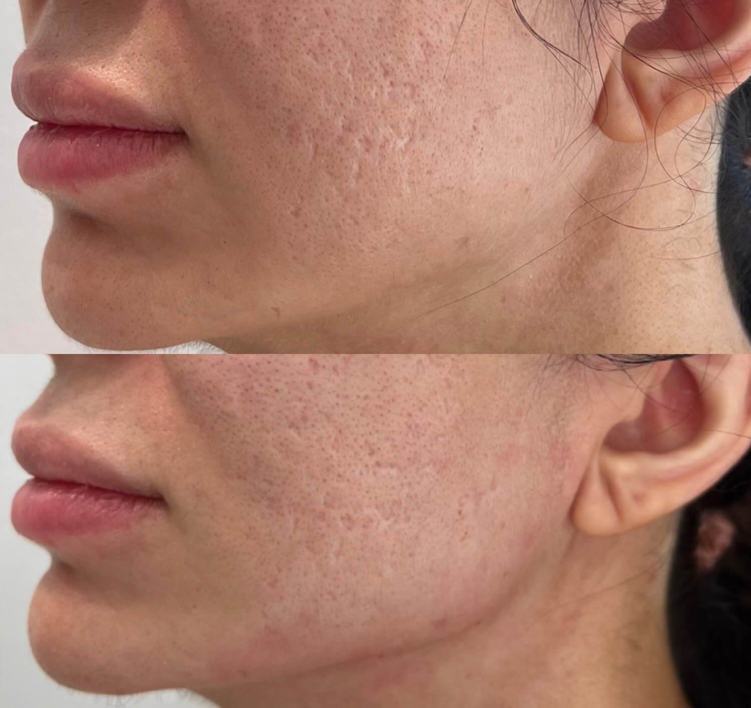 Christine Yanikian before and after botox.jpg