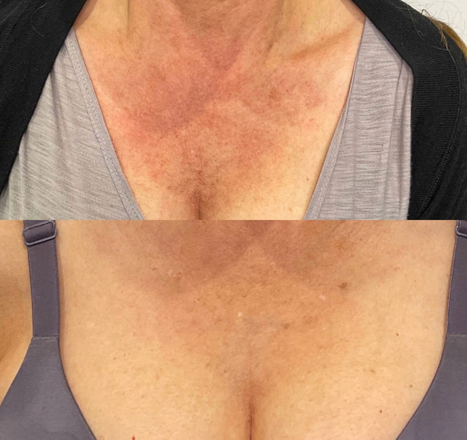Cleavage/ Chest Color and Texture Repair