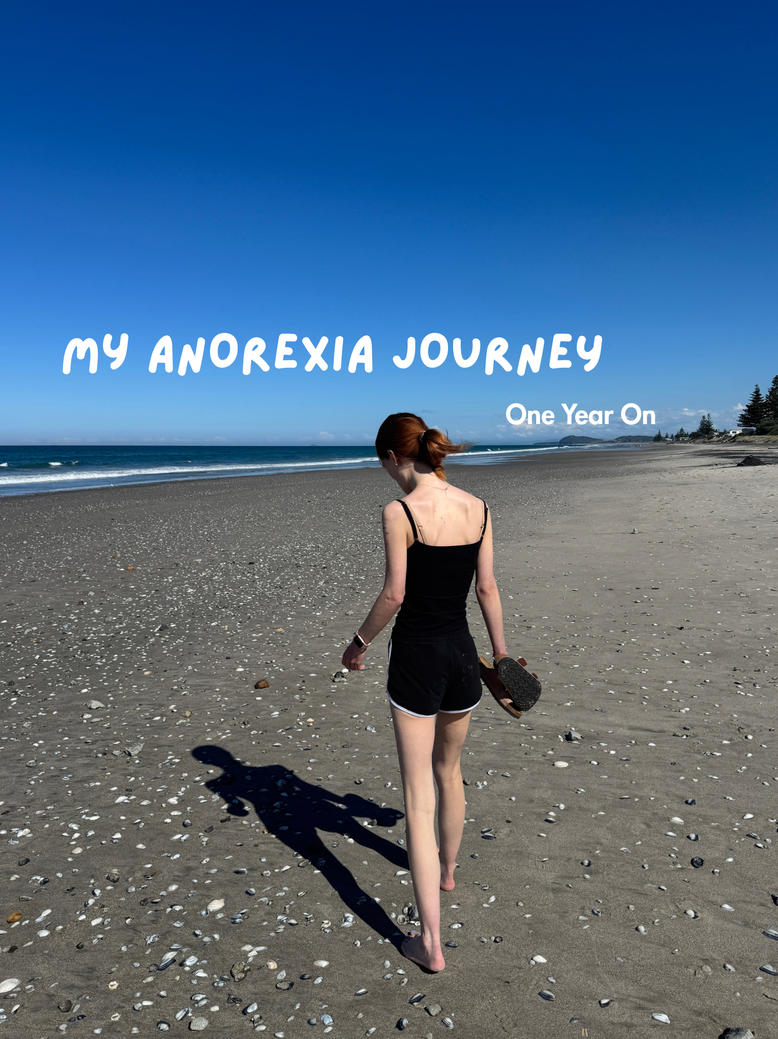 My Anorexia Journey: What I Have Learned a Year After Diagnosis