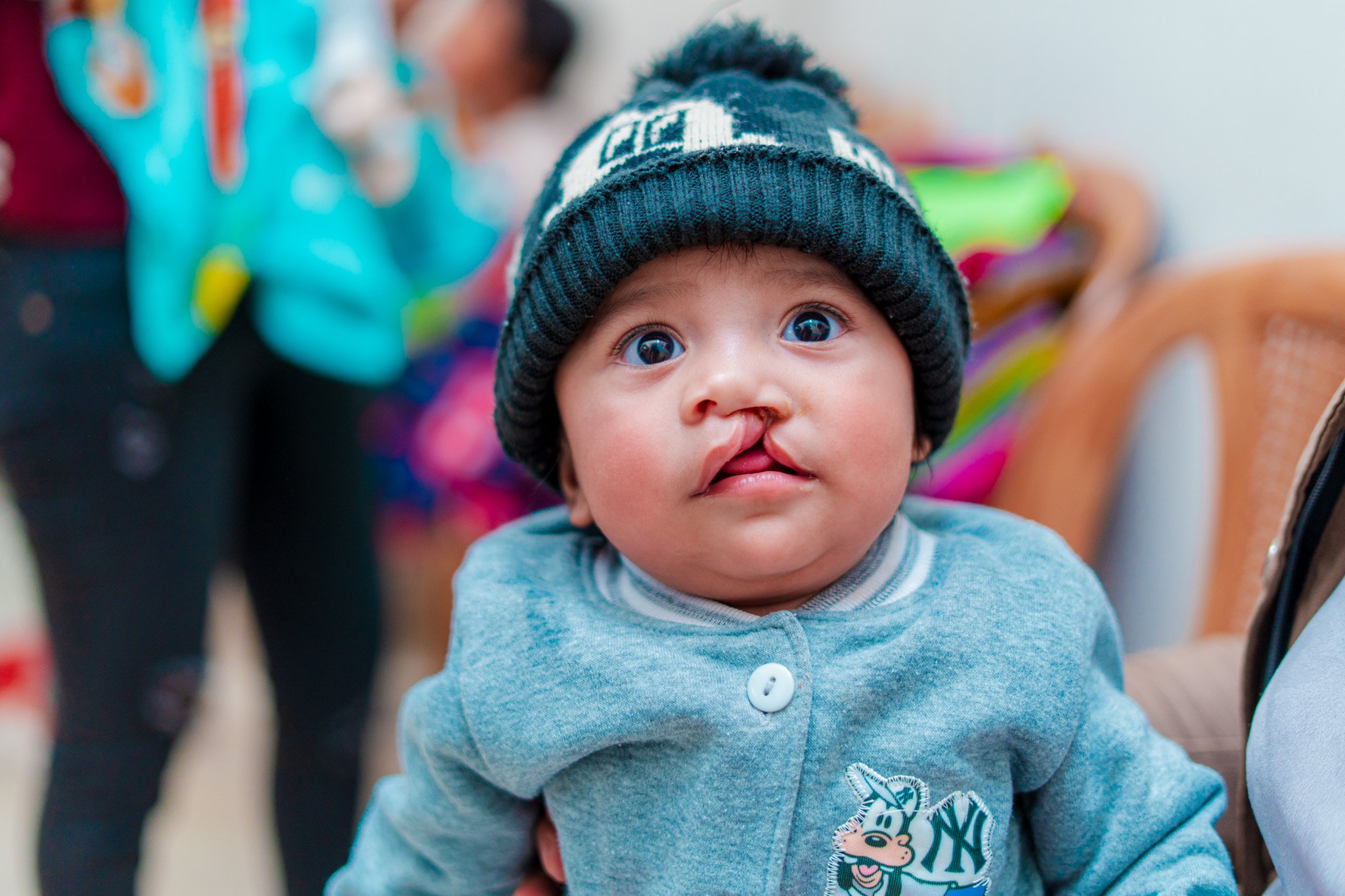 Finn Foundation - CLP and Microtia