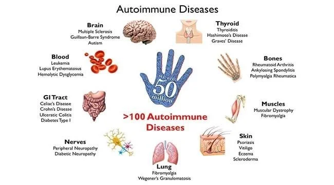 chart of regular symptoms of autoimmune diseases