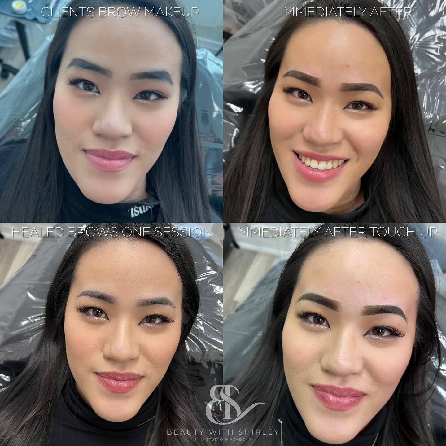 Good brows DO make a a huge difference in your whole facial features.

It can make you look:
✅ 𝒚𝒐𝒖𝒏𝒈𝒆𝒓 by creating a beautiful shape that suits your face 
✅ 𝒂𝒘𝒂𝒌𝒆 by lifting your eyebrows and not having them droopy
✅ 𝒍𝒆𝒔𝒔 𝒂𝒏𝒈𝒓𝒚  