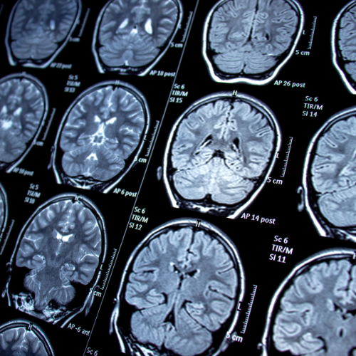 neurology uCF image.png