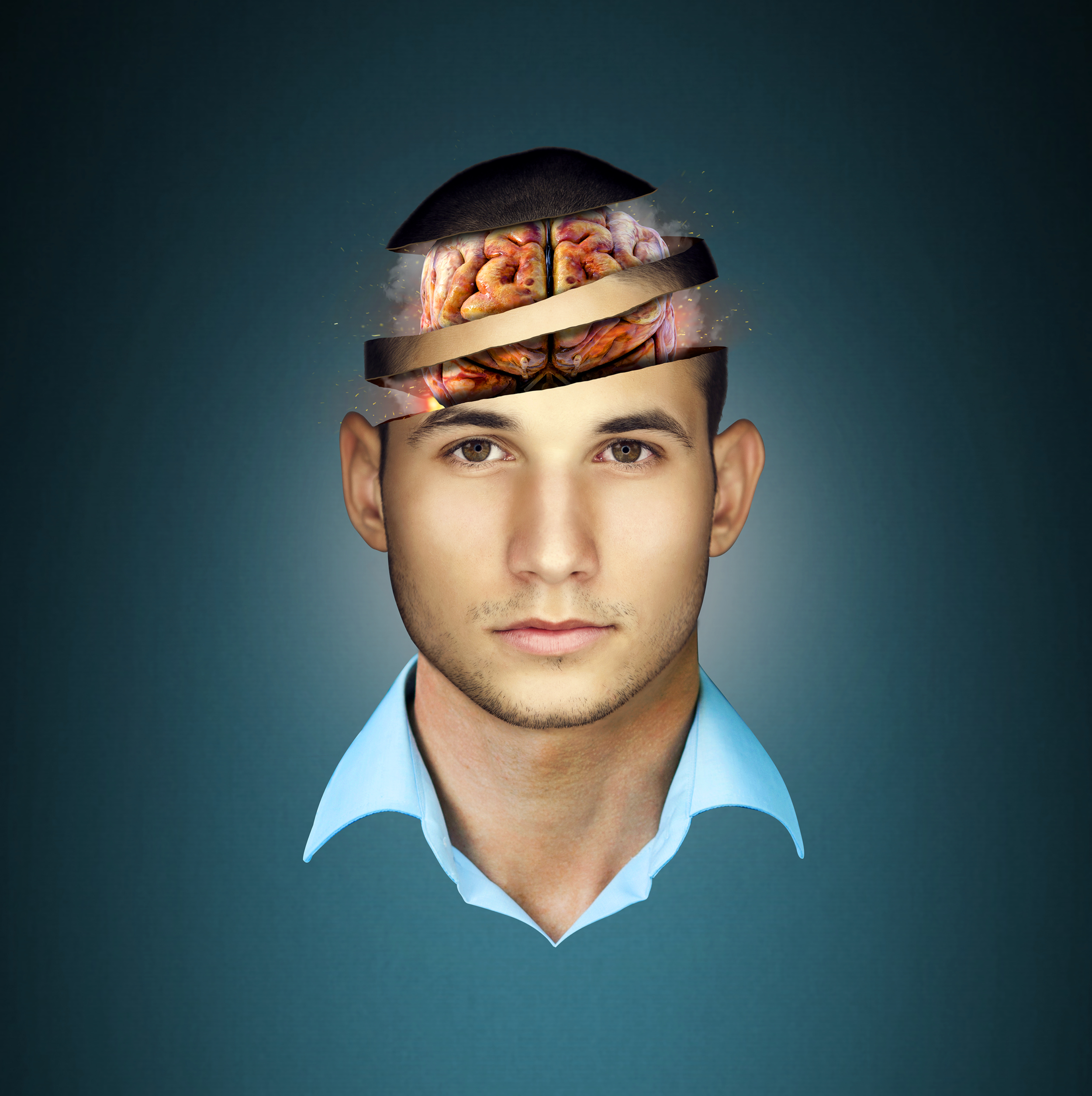 02HighResBrain.png