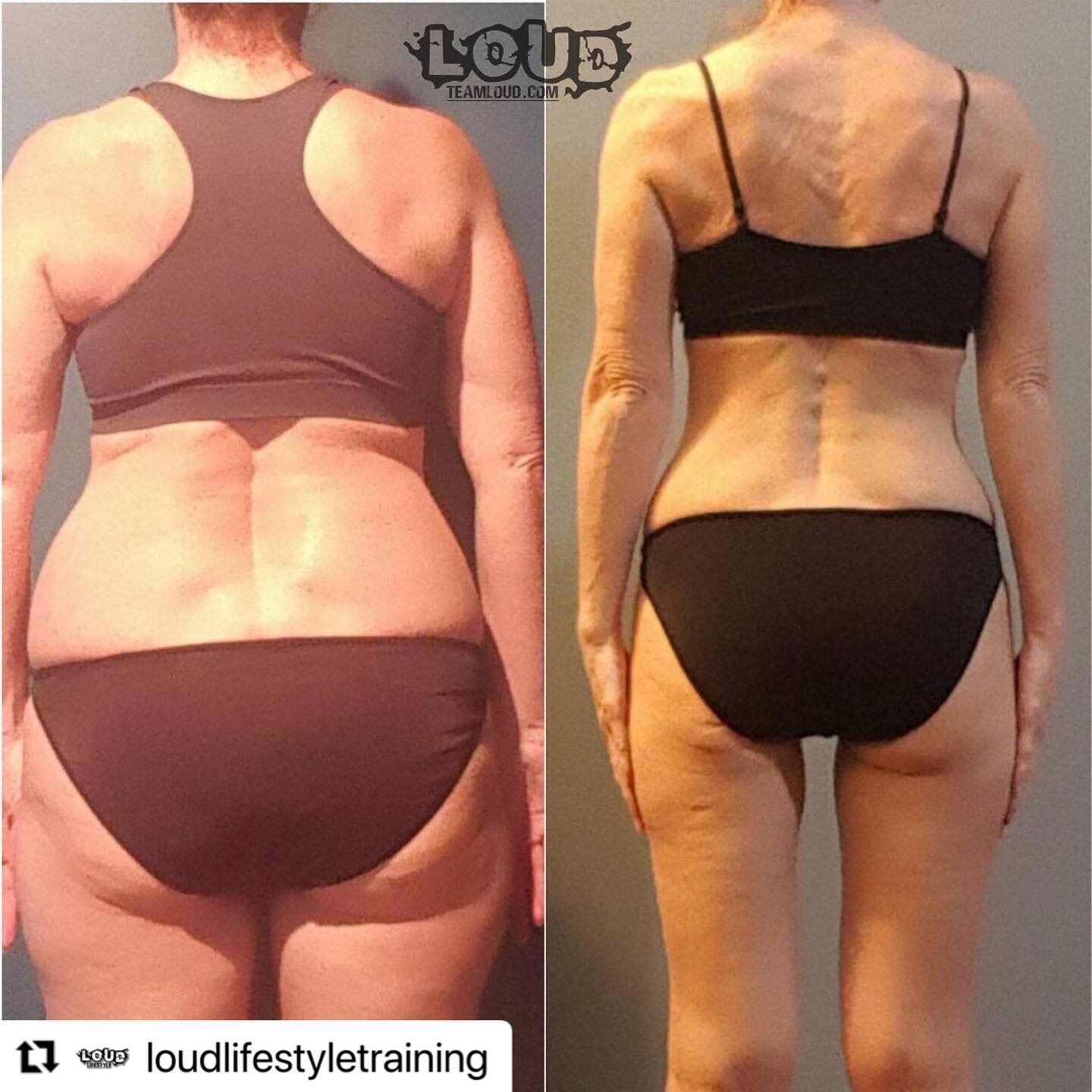 #Repost @loudlifestyletraining with @make_repost
・・・
Here's an EPIC transformation from a client that would like to remain anonymous.
➖
She worked with coach @fitbaileywhit to pull off about 30lbs in just 4 months.
➖
This client excells at fat loss, 