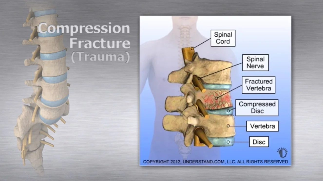 Informational Videos — reVive Spine Center